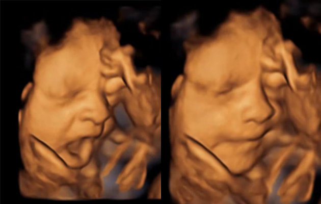 yawning before birth in utero